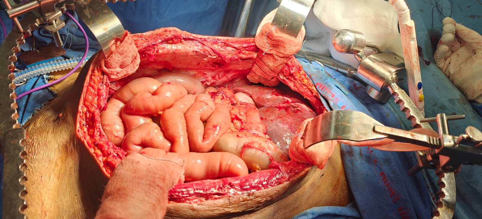 Best CRS Surgeon in Delhi